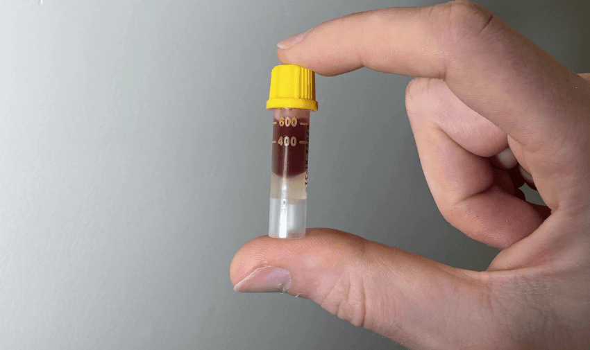 Hand holding a small home blood sample vial – Convenient health checks at a discount for disabled members and carers.