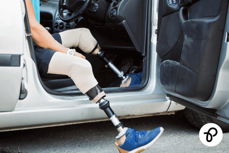 Disabled person with prosthetic legs getting into a car, illustrating vehicle tax refunds and backdated car tax rules linked to PIP mobility support, UK disability discounts and financial help for long-term health conditions